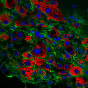 Confocal microscopic image of fat cells