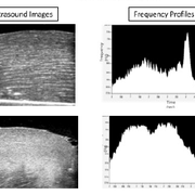 ultrasound images on digital screen